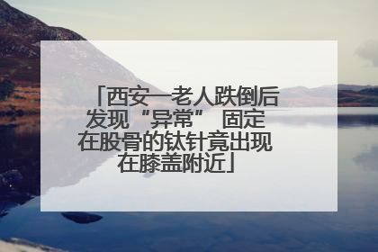西安一老人跌倒后发现“异常” 固定在股骨的钛针竟出现在膝盖附近